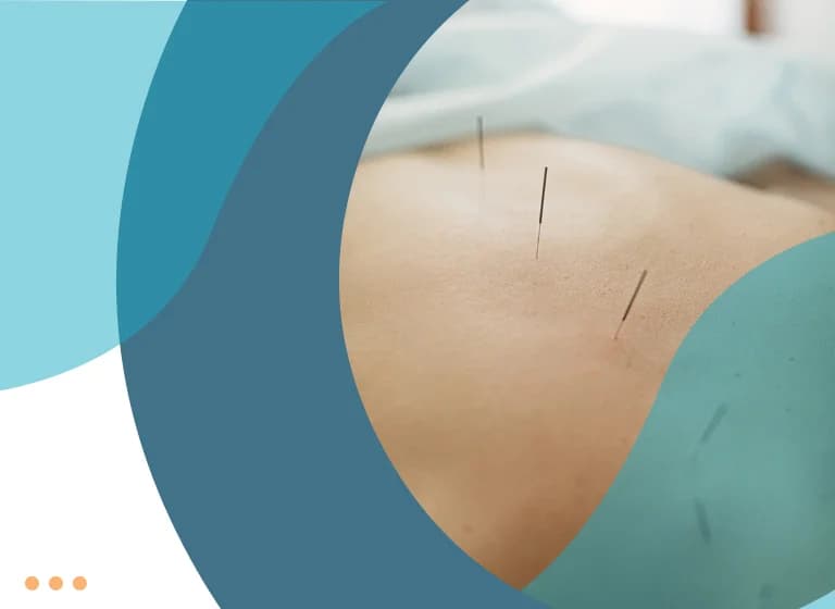 Τεχνική Ξηράς Βελόνας (Dry Needling)